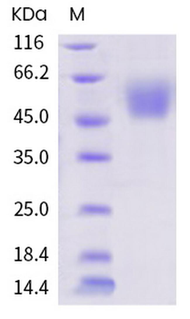 SARS-CoV-2 Spike Protein S1 His-Avi Tag Protein