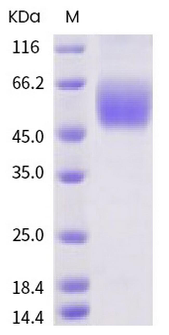 SARS-CoV-2 Spike Protein S1 His-Avi Tag Protein