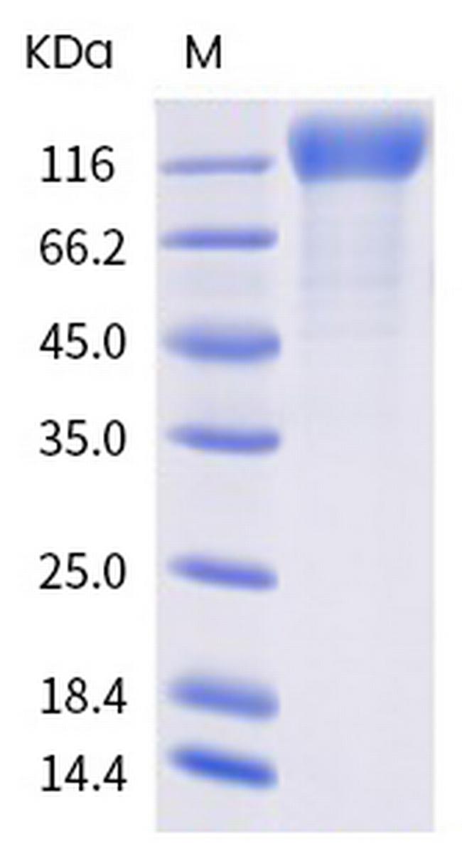 SARS-CoV-2 Spike Protein S1 (mutant) His-tag Protein