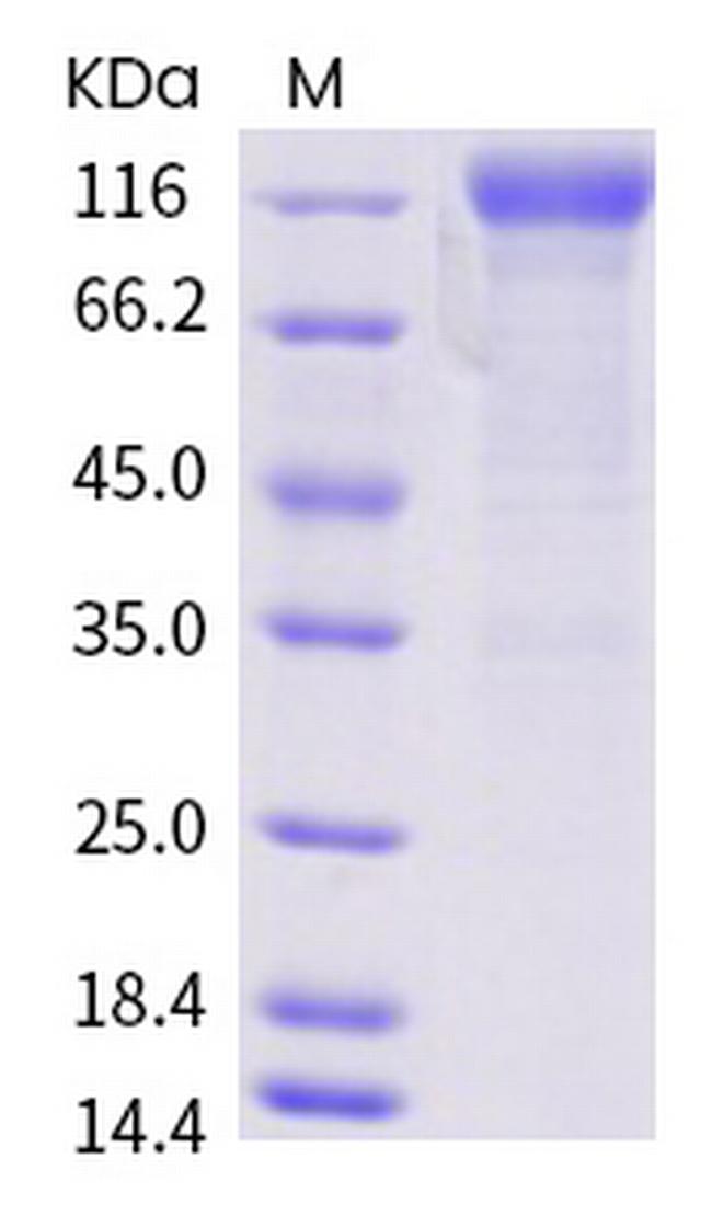 SARS-CoV-2 Spike Protein S1 (D614G) Fc Chimera Protein
