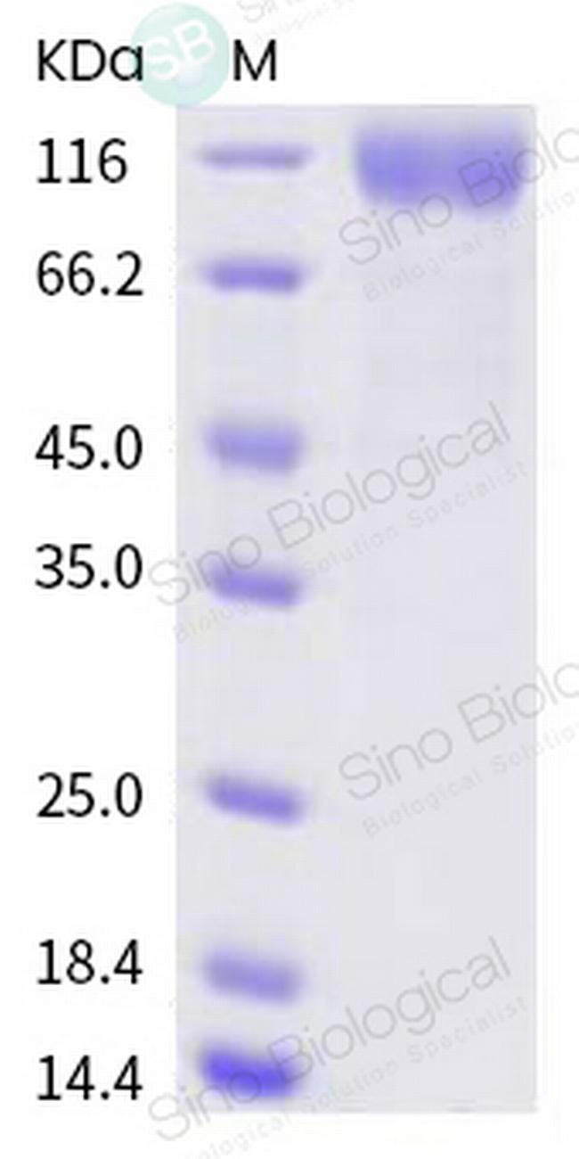 SARS-CoV-2 Spike Protein S1 (D614G) His-tag Protein