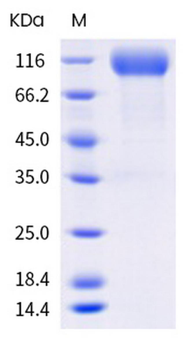 SARS-CoV-2 Spike Protein S1 (mutant) His-tag Protein
