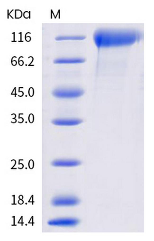 SARS-CoV-2 Spike Protein S1 (mutant) His-tag Protein