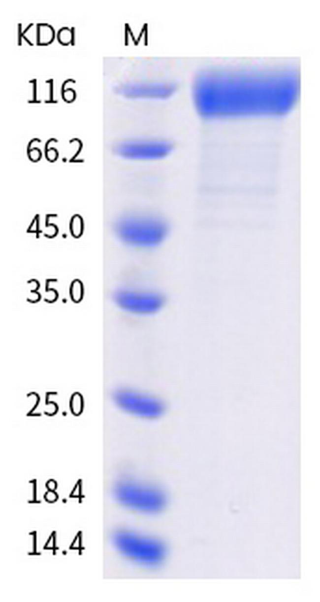 SARS-CoV-2 Spike Protein S1 (mutant) His-tag Protein