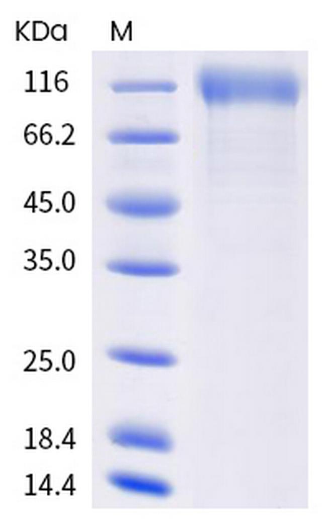 SARS-CoV-2 Spike Protein S1 (mutant) His-tag Protein