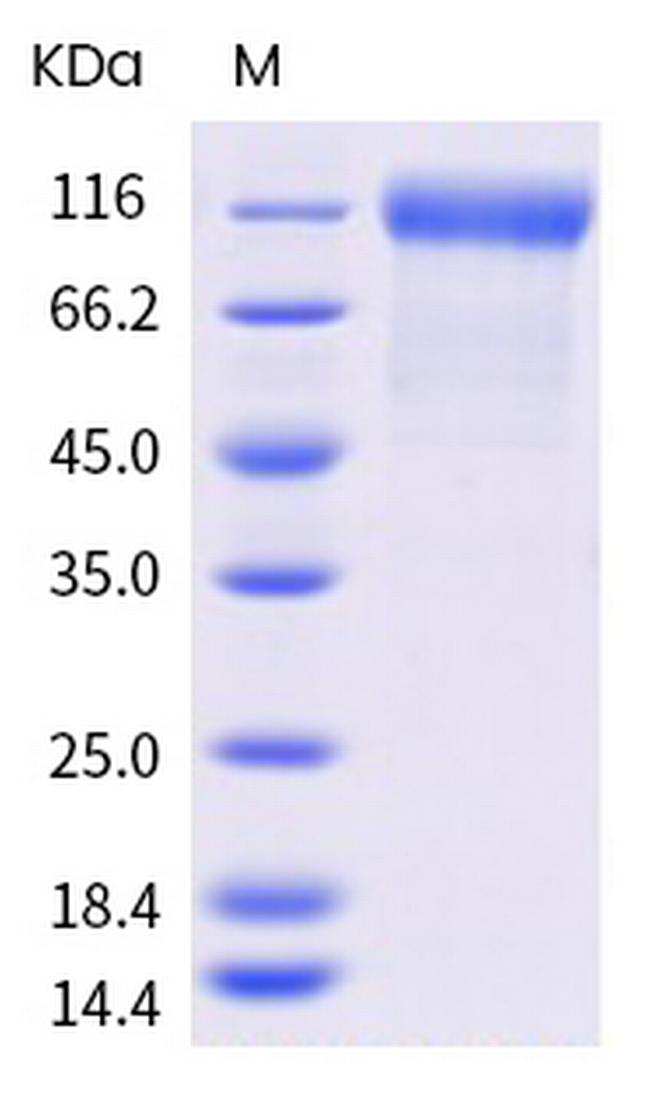 SARS-CoV-2 Spike Protein S1 (mutant) His-tag Protein