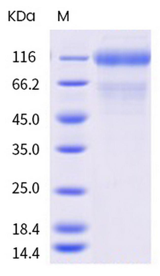 SARS-CoV-2 Spike Protein S1 (mutant) His-tag Protein