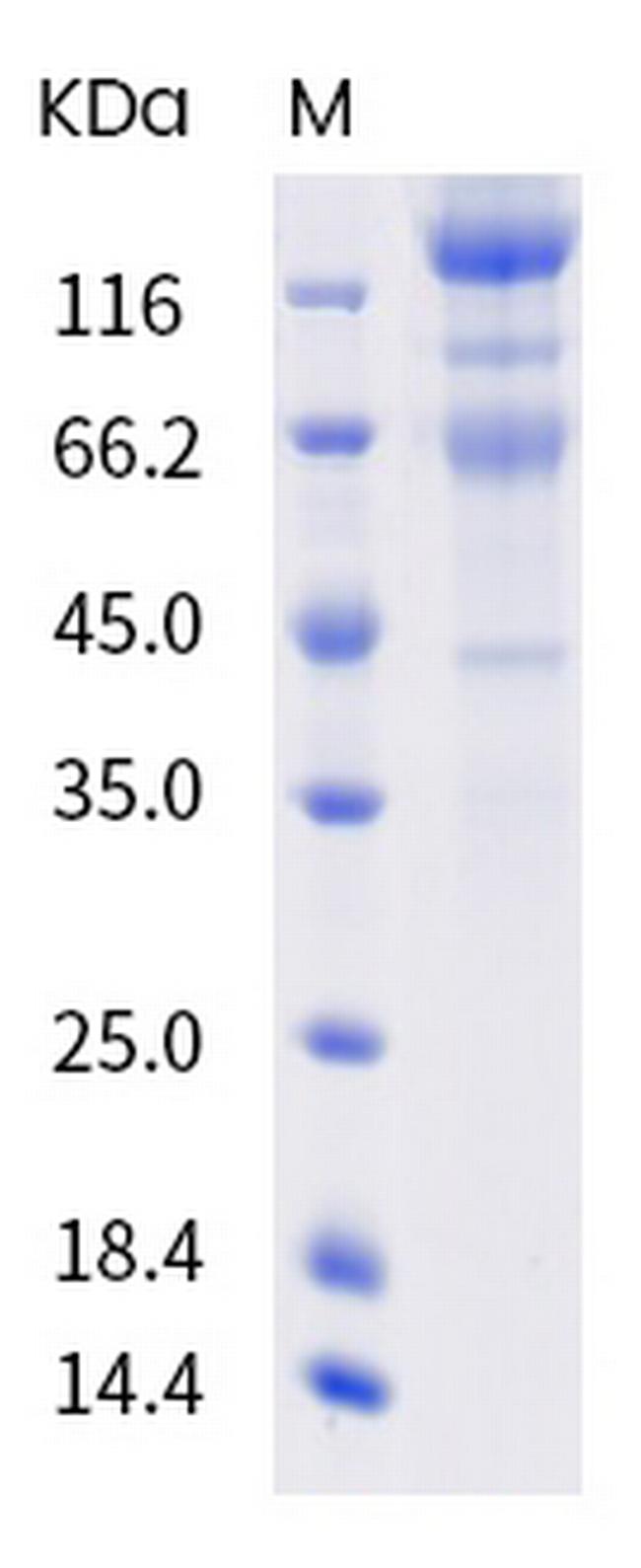 SARS-CoV-2 Spike Protein S1/S2 (B.1.351) His-tag Protein