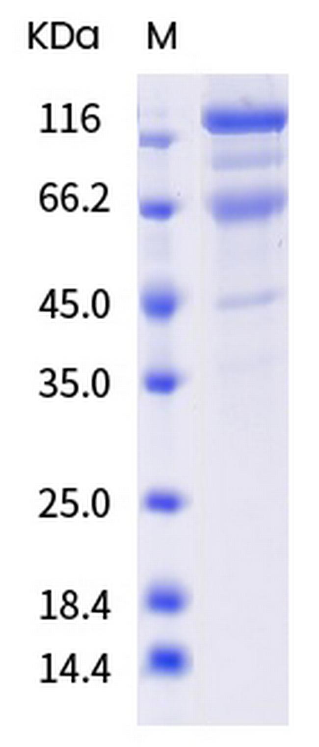 SARS-CoV-2 Spike Protein S1/S2 (P.1) His-tag Protein