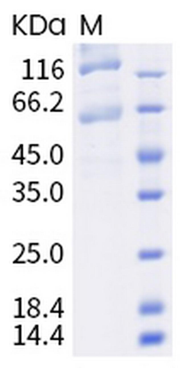 SARS-CoV-2 Spike Protein S1/S2 (P.1) His-tag Protein
