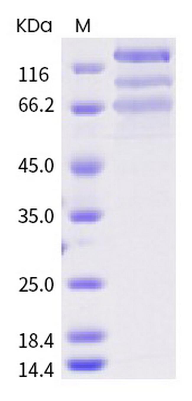 SARS-CoV-2 Spike Protein S1/S2 (D614G) His-tag Protein
