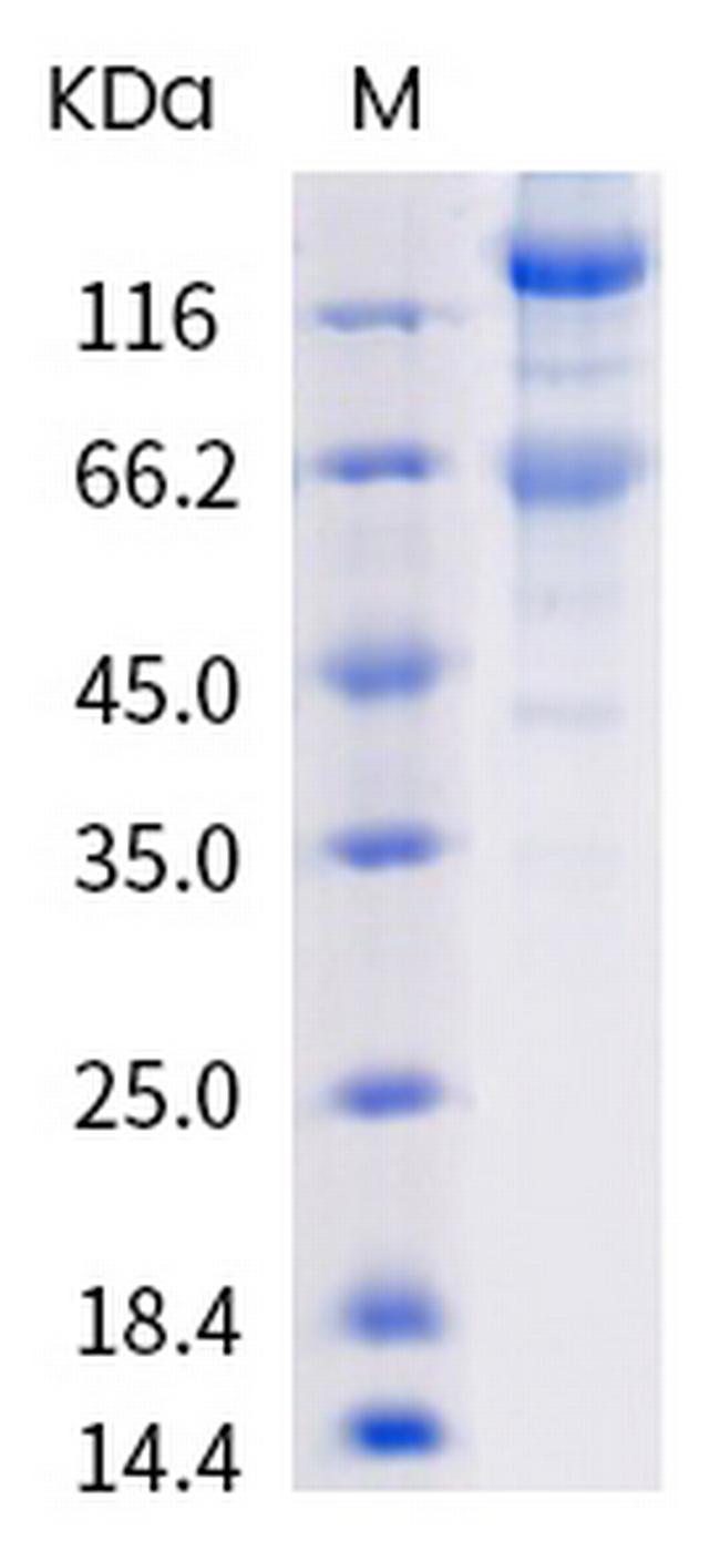 SARS-CoV-2 Spike Protein S1/S2 (mutant) His-tag Protein