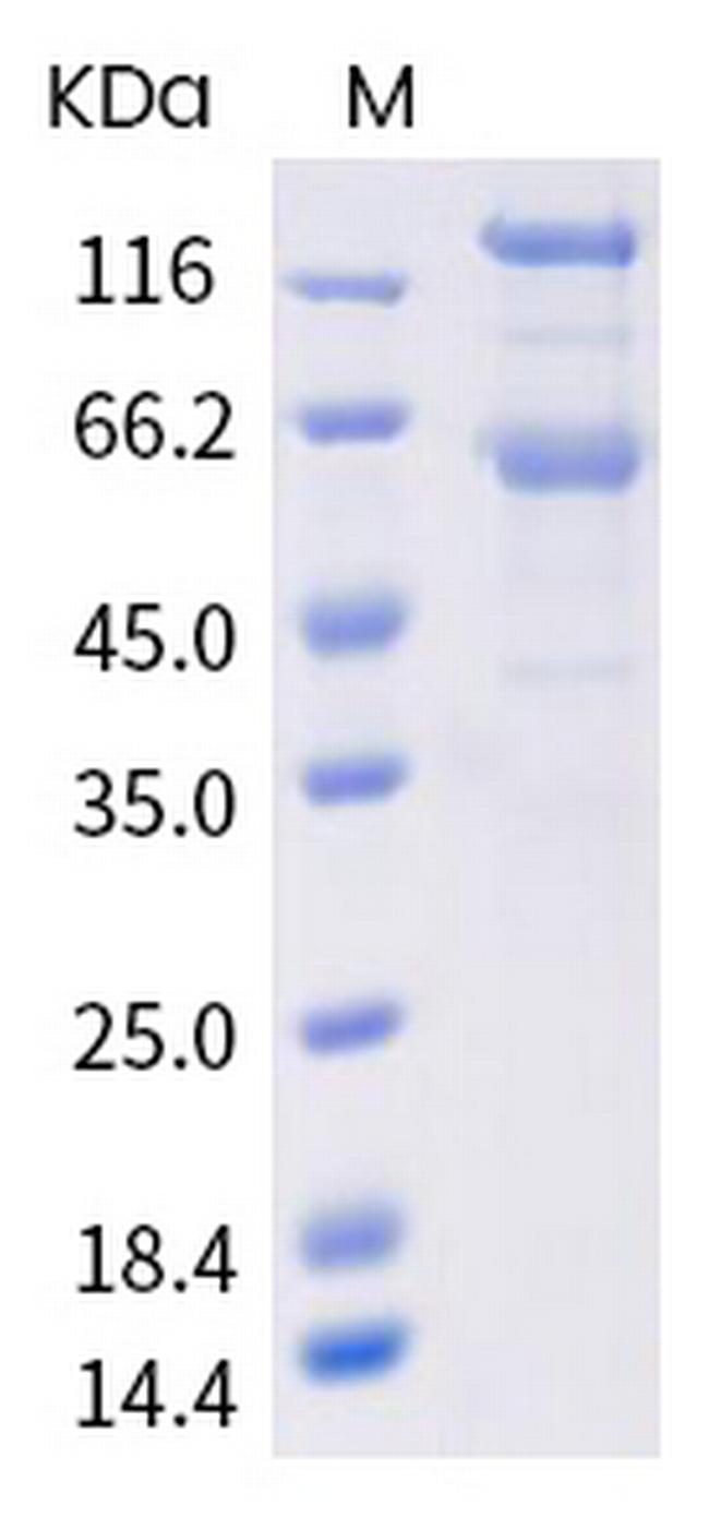 SARS-CoV-2 Spike Protein S1/S2 (mutant) His-tag Protein