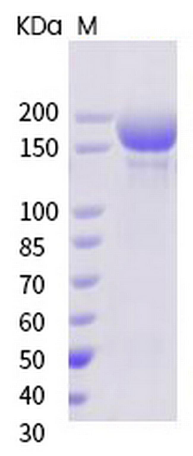 SARS-CoV-2 Spike Protein S1/S2 (mutant) His-tag Protein