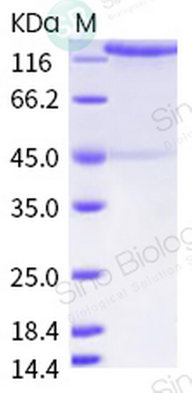 SARS-CoV-2 Spike Protein S1/S2 (mutant) His-tag Protein