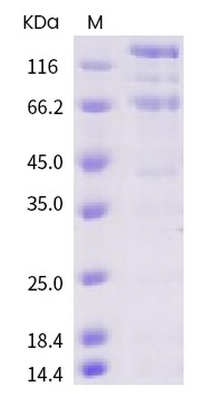 SARS-CoV-2 Spike Protein S1/S2 His-Avi Tag Protein