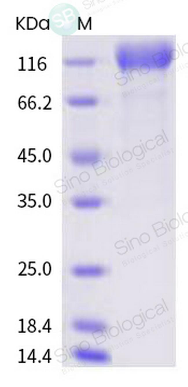 SARS-CoV-2 Spike Protein S1 His-Avi Tag Protein