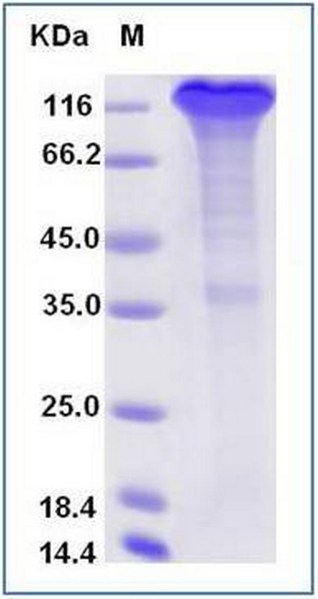 SARS-CoV-2 Spike Protein S1 Fc Chimera Protein