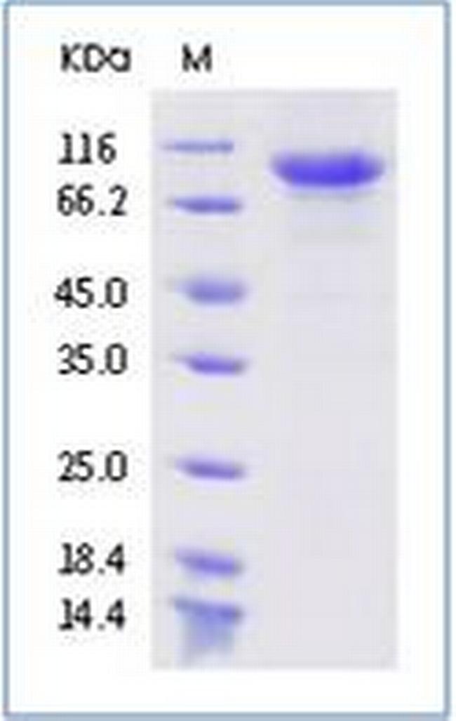 SARS-CoV-2 Spike Protein S1 His-tag Protein