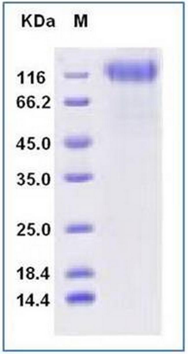 SARS-CoV-2 Spike Protein S1 His-tag (HPLC verified) Protein