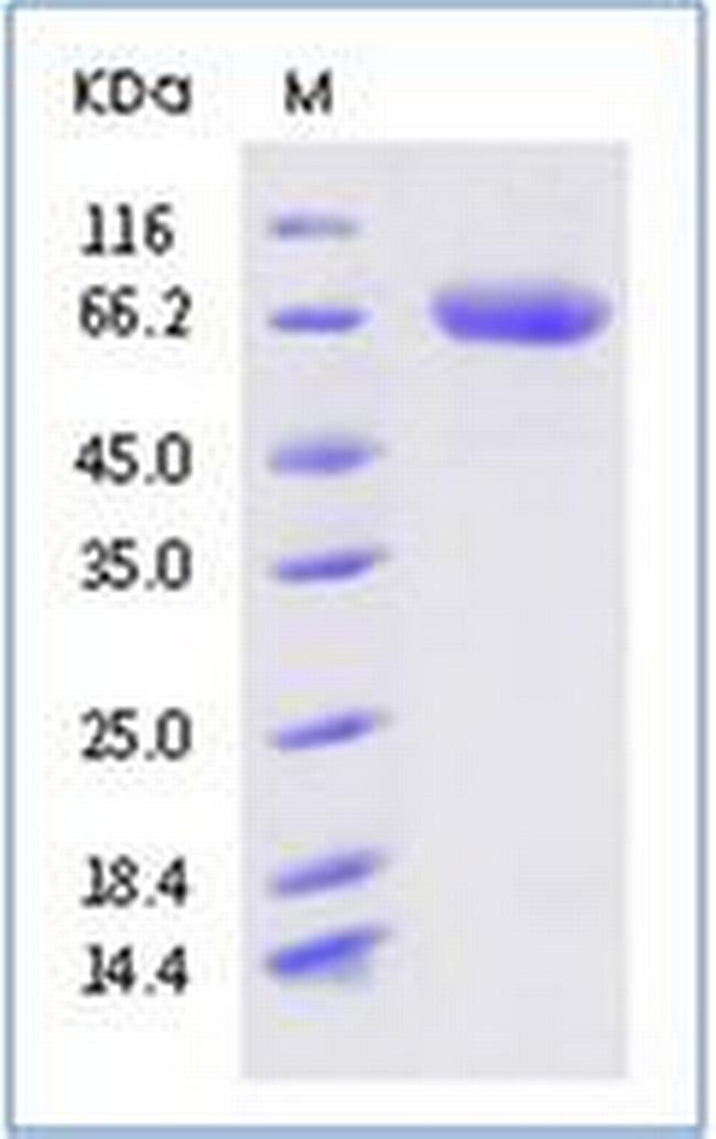 SARS-CoV-2 Spike Protein S2 His-tag Protein