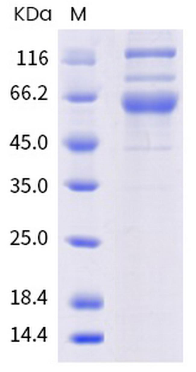 SARS-CoV-2 Spike Protein S1/S2 (AY.4.2) His-tag Protein