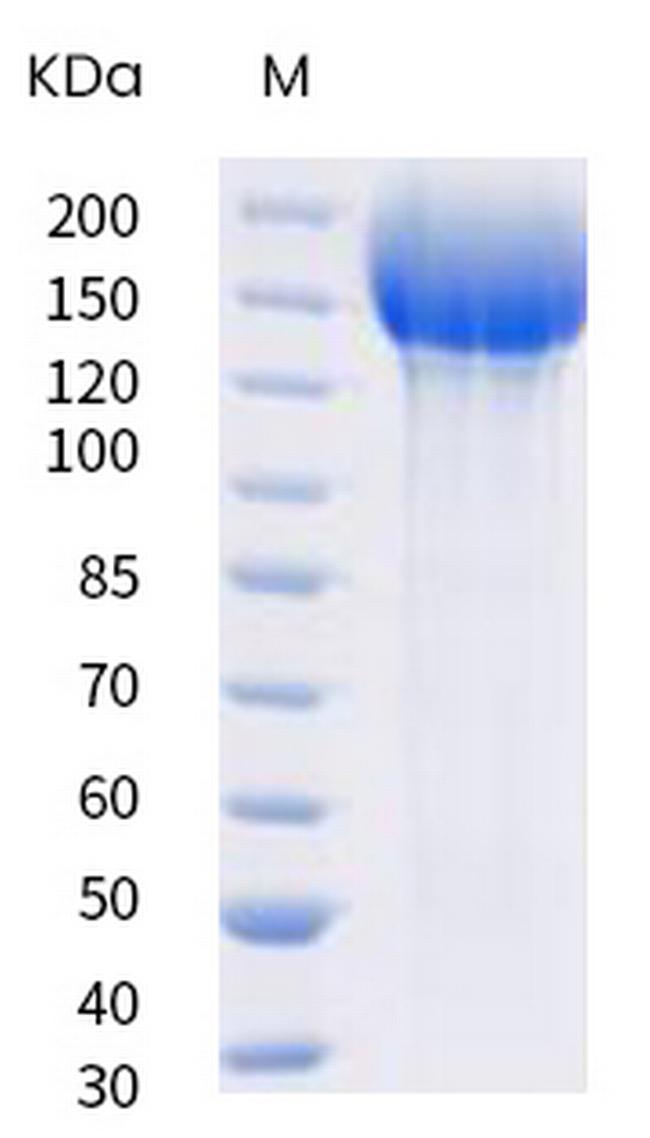 SARS-CoV-2 Spike Protein S1/S2 (B.1.351) His-tag, trimer Protein
