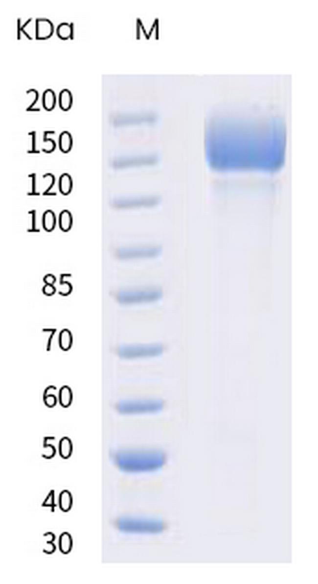 SARS-CoV-2 Spike Protein S1/S2 (B.1.617.1) His-tag, trimer Protein