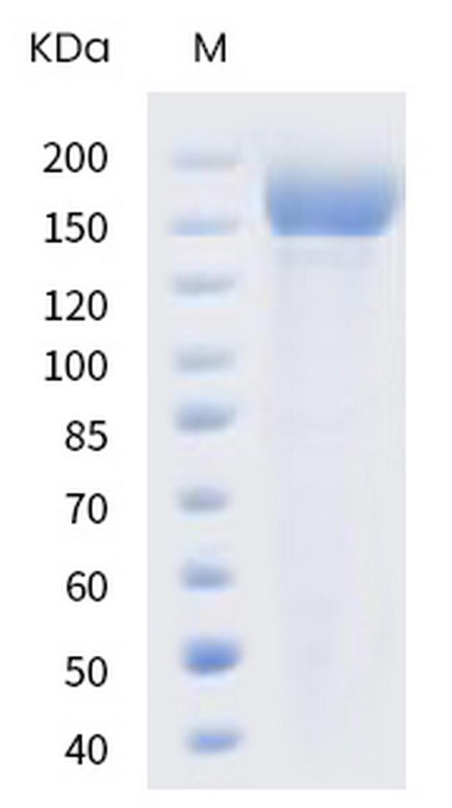 SARS-CoV-2 Spike Protein S1/S2 (B.1.617.2) His-tag, trimer Protein
