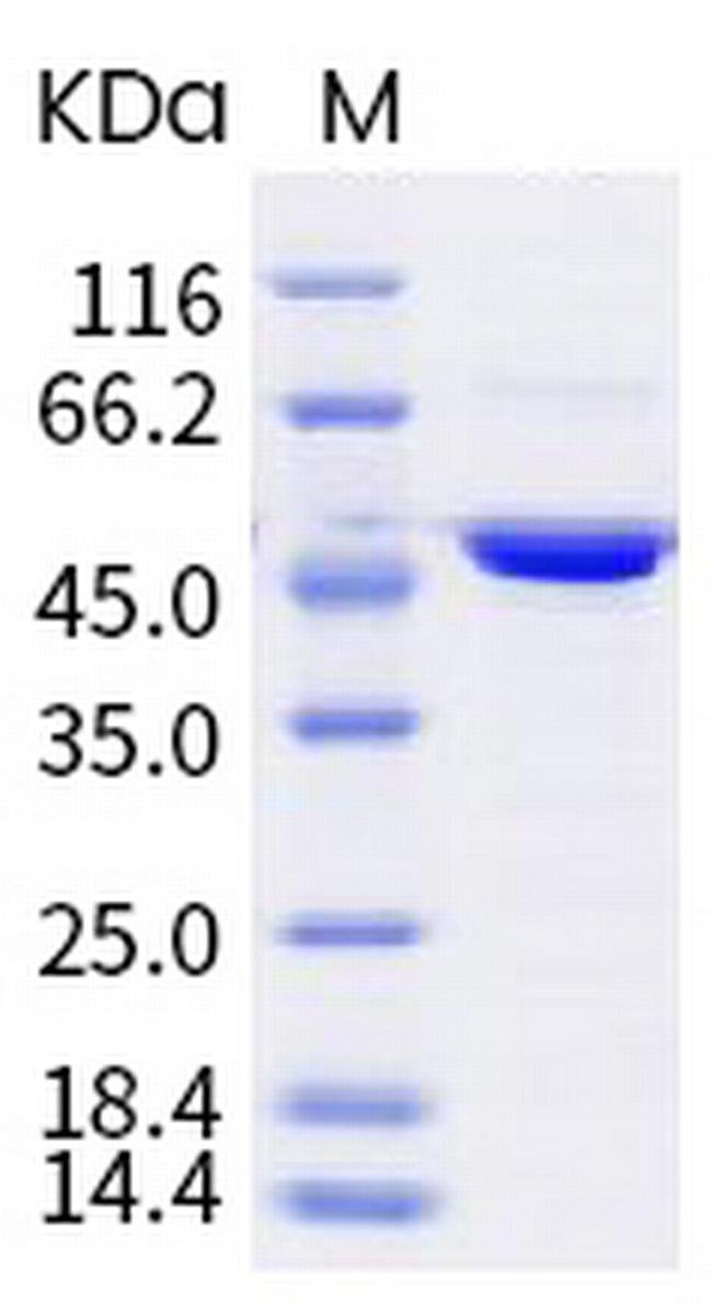 SARS-CoV-2 Nucleocapsid (mutant) His-tag Protein