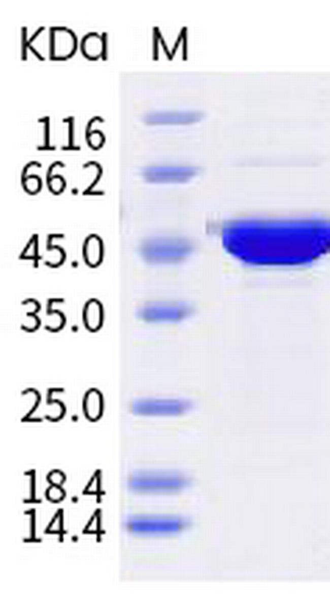 SARS-CoV-2 Nucleocapsid (A12G, T205I) His-tag Protein