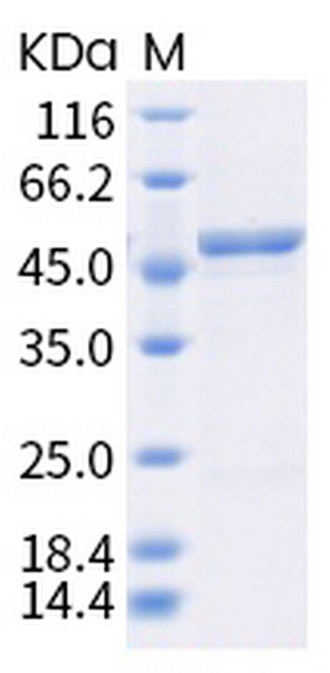 SARS-CoV-2 Nucleocapsid (A220V) His-tag Protein