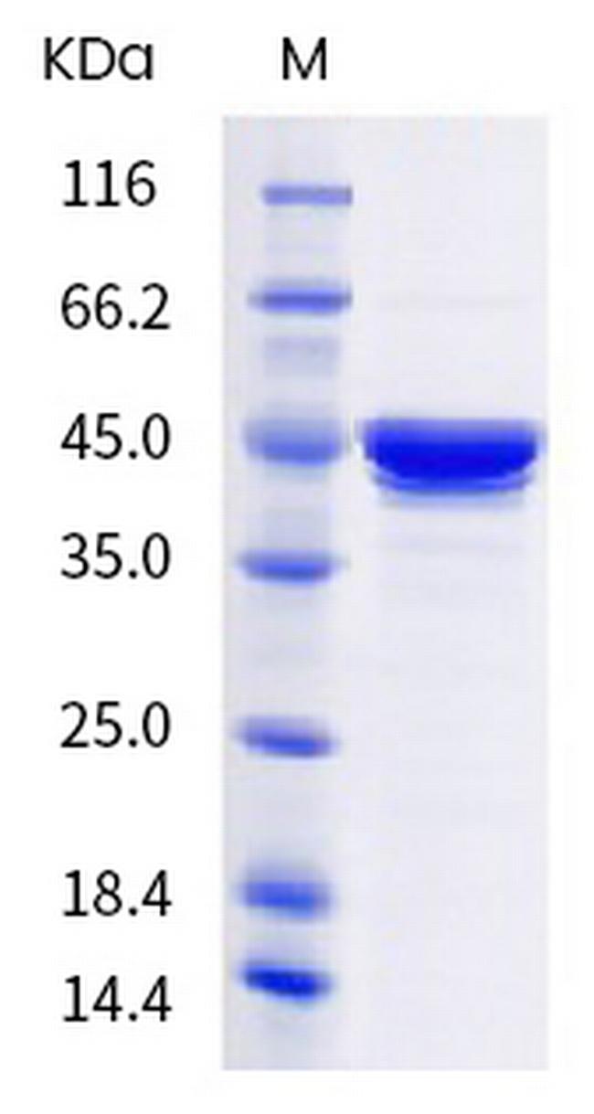 SARS-CoV-2 Nucleocapsid (B.1.617.2) His-tag Protein
