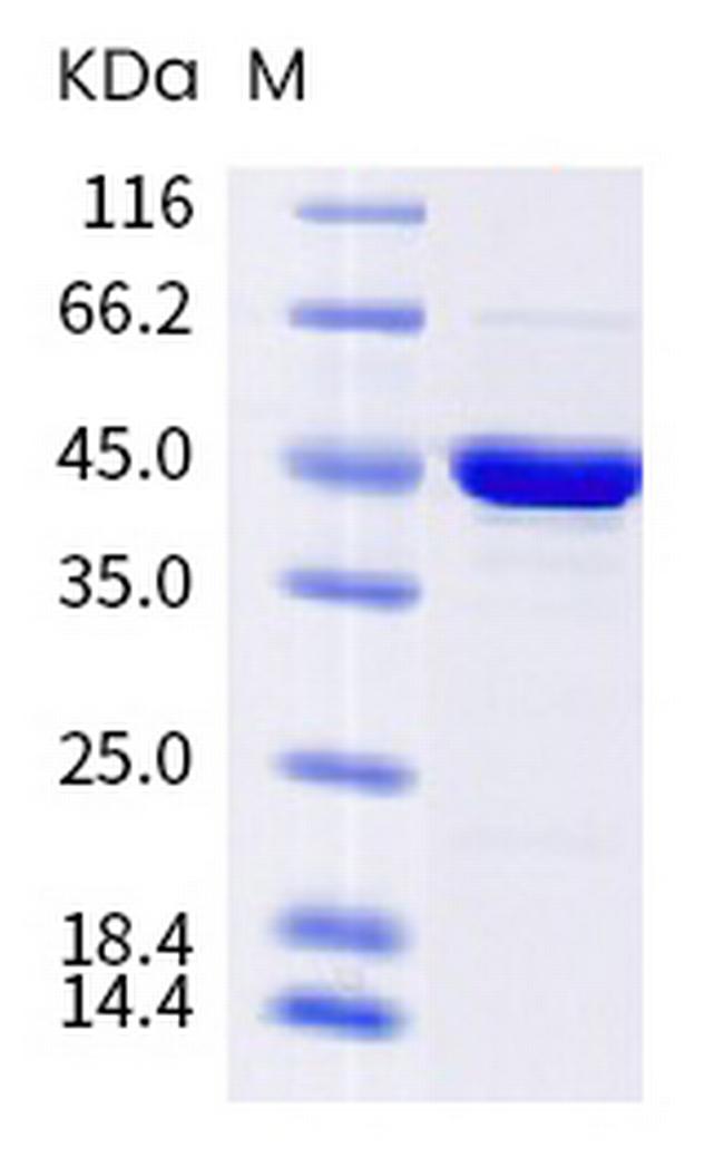 SARS-CoV-2 Nucleocapsid (B.1.618) His-tag Protein
