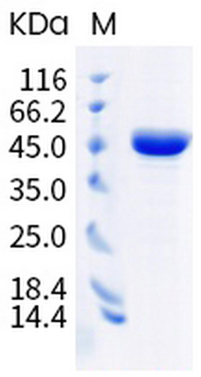 SARS-CoV-2 Nucleocapsid (M234L) His-tag Protein