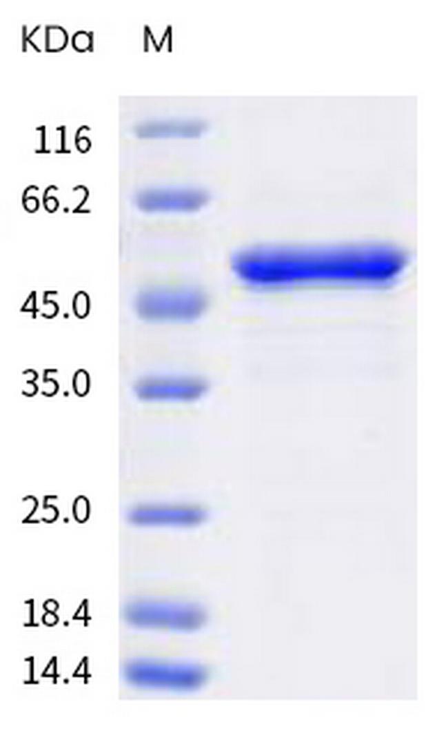 SARS-CoV-2 Nucleocapsid (C.37) His-tag Protein