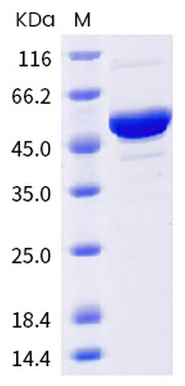 SARS-CoV-2 Nucleocapsid (C.1.2) His-tag Protein