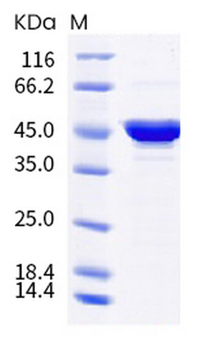 SARS-CoV-2 Nucleocapsid (B.1.526) His-tag Protein