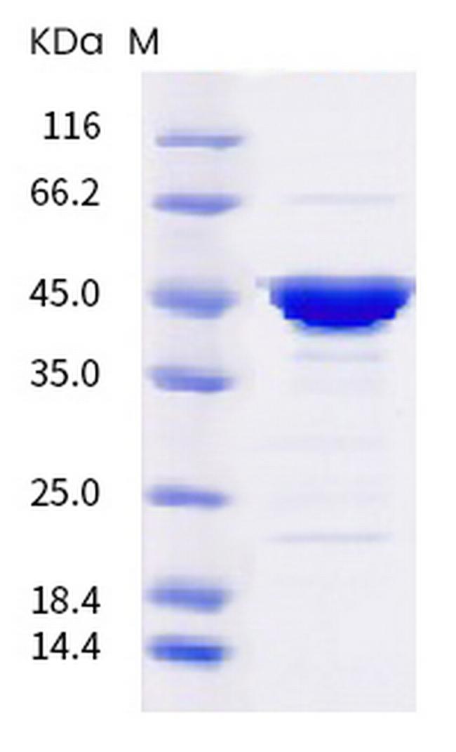 SARS-CoV-2 Nucleocapsid (P67S) His-tag Protein