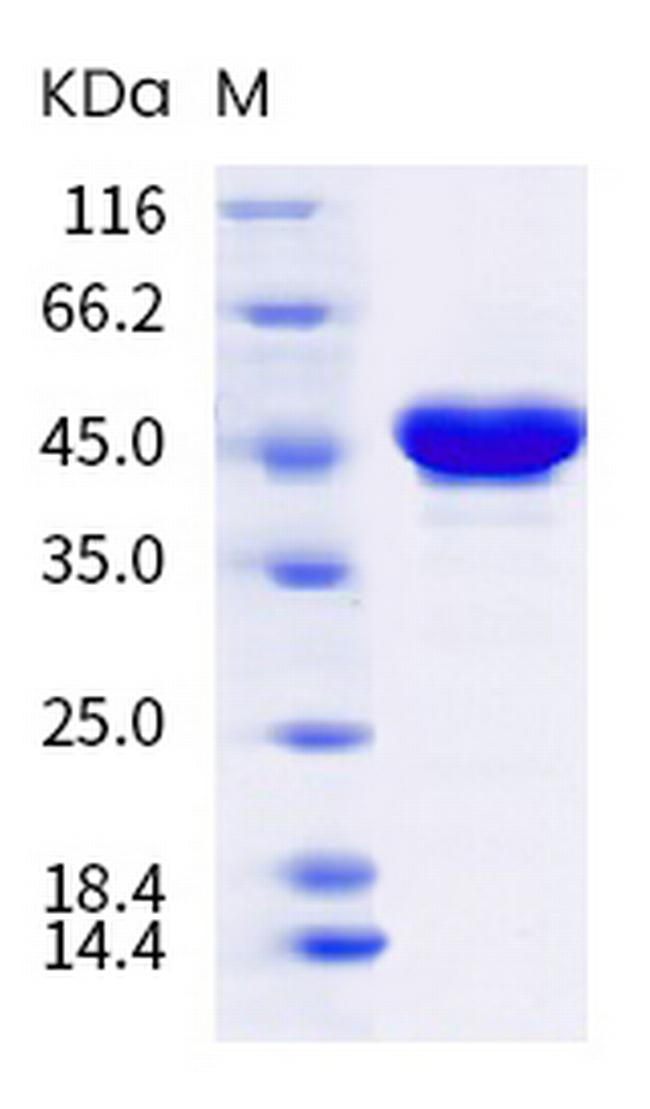 SARS-CoV-2 Nucleocapsid (B.1.617.3) His-tag Protein