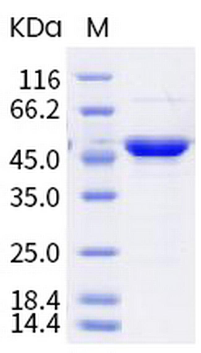 SARS-CoV-2 Nucleocapsid (B.1.617; B.1.617.1) His-tag Protein