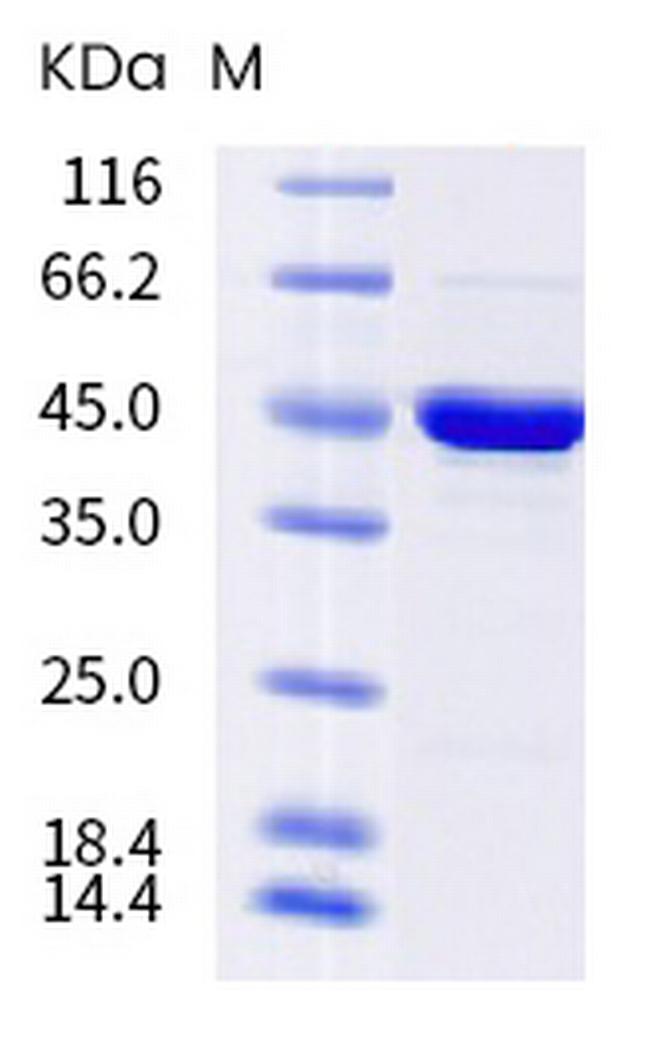 SARS-CoV-2 Nucleocapsid (S202N) His-tag Protein