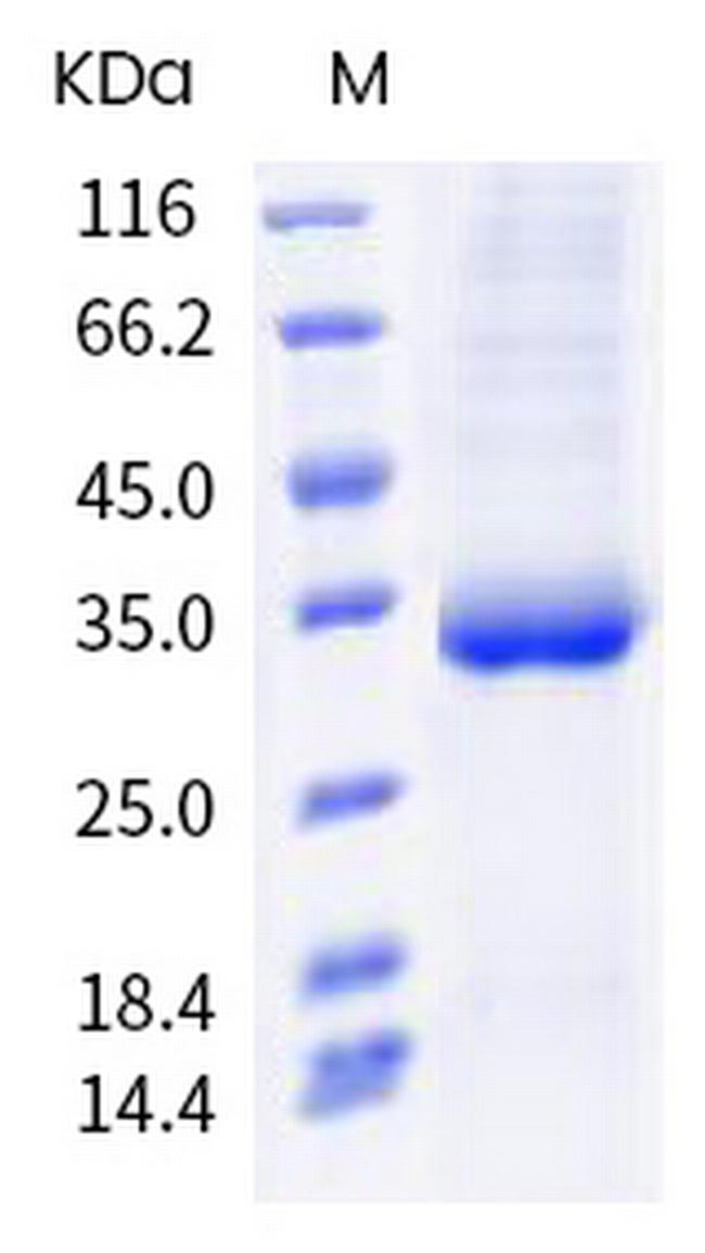 SARS-CoV-2 Spike Protein (RBD) (A475T) His-tag Protein