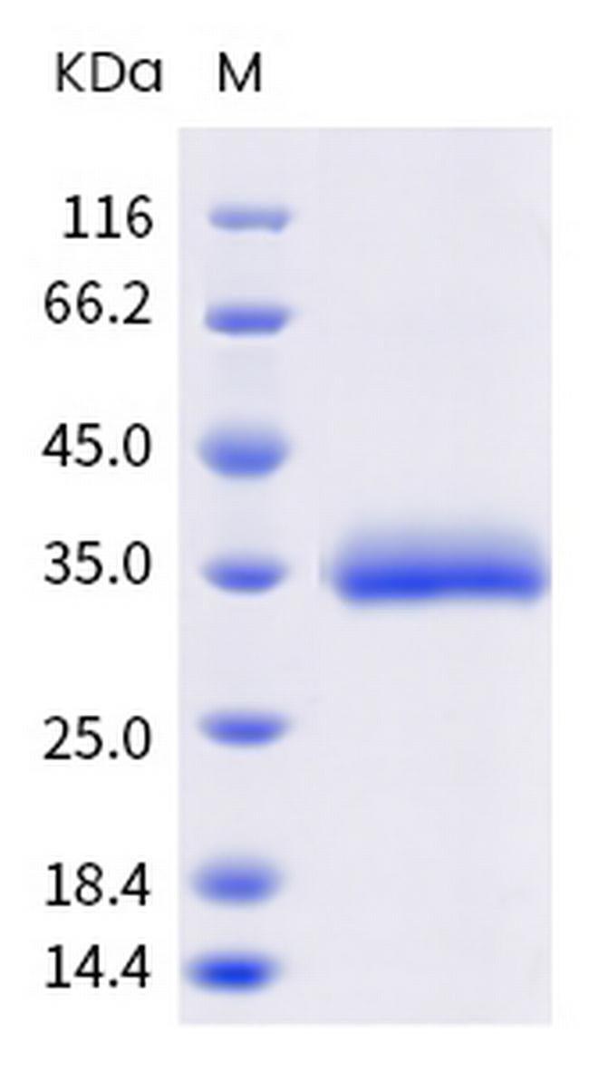 SARS-CoV-2 Spike Protein (RBD) (E471A) His-tag Protein