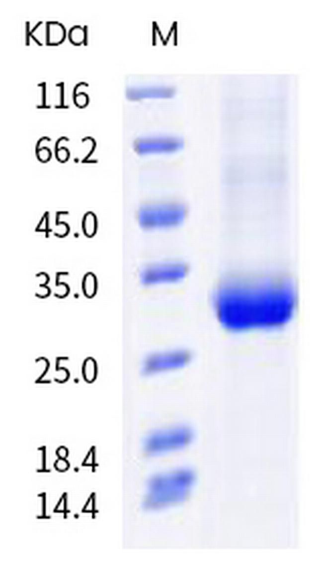 SARS-CoV-2 Spike Protein (RBD) (E471D) His-tag Protein