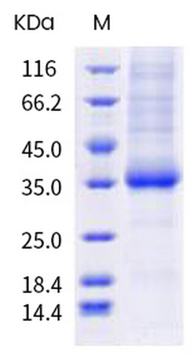 SARS-CoV-2 Spike Protein (RBD) (E484A) His-tag Protein