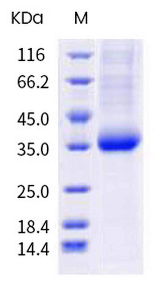 SARS-CoV-2 Spike Protein (RBD) (E484D) His-tag Protein