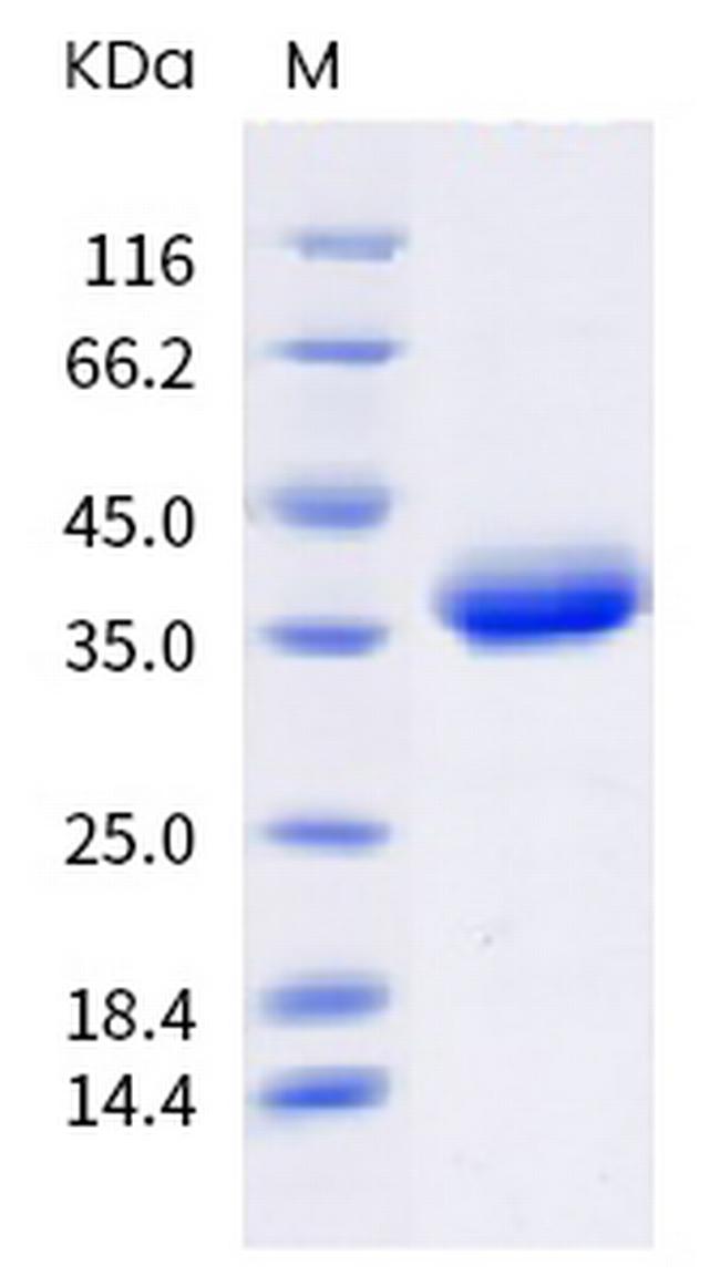 SARS-CoV-2 Spike Protein (RBD) (mutant) His-Avi Tag Protein
