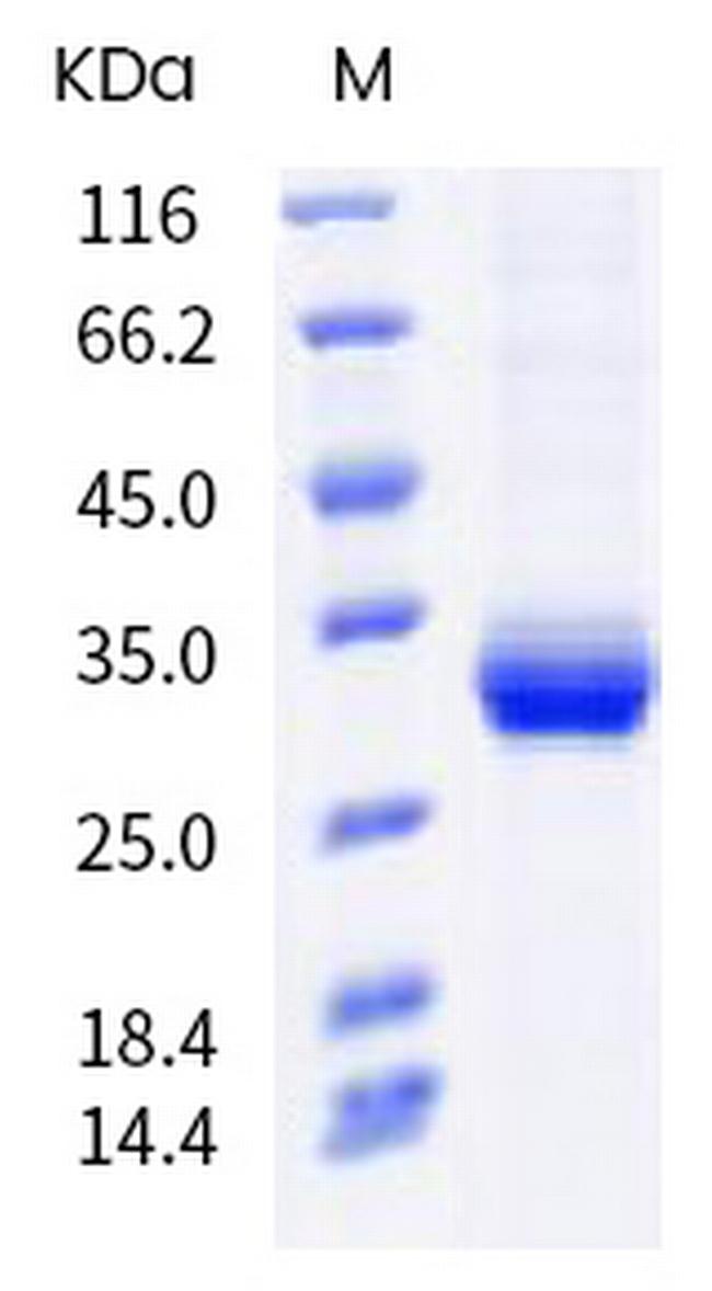 SARS-CoV-2 Spike Protein (RBD) (F456Y) His-tag Protein