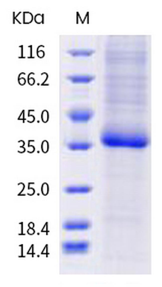 SARS-CoV-2 Spike Protein (RBD) (G476A) His-tag Protein